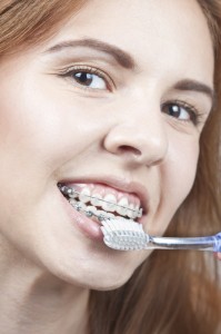 Tratament ortodontic adulti